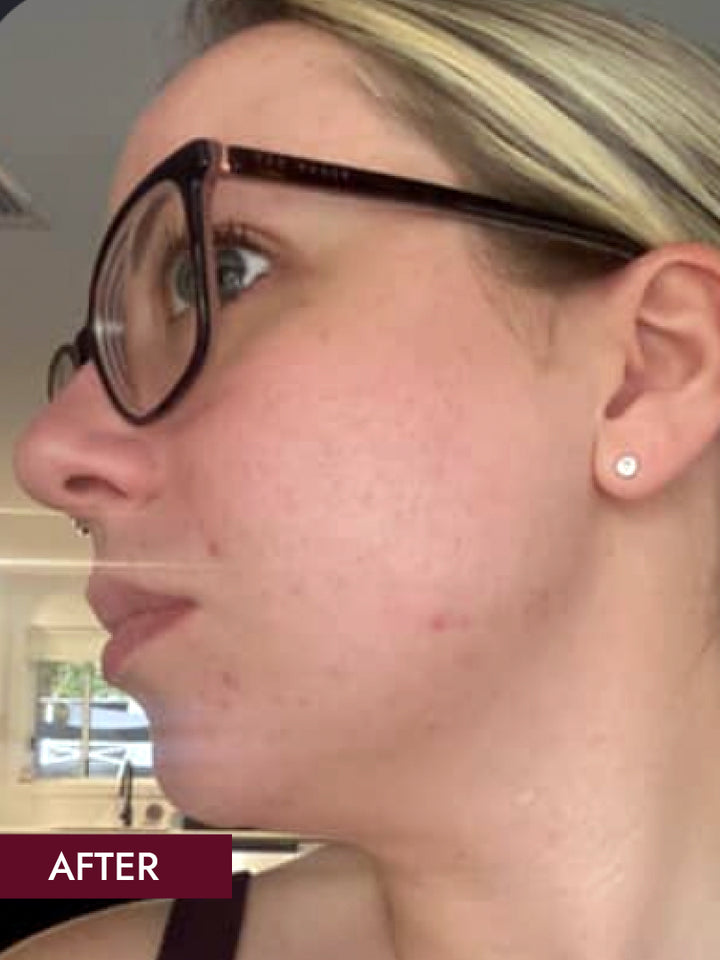 Matilda - Age 34