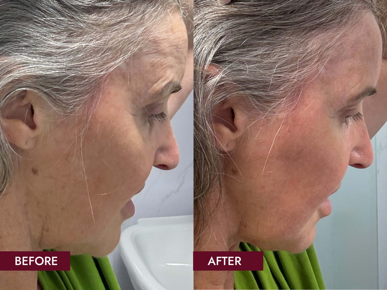 Before_and_Afters_SIDE_BY_SIDE7_Large_d8b2e95c-388c-414e-b71a-d43c31f3baf1.jpg