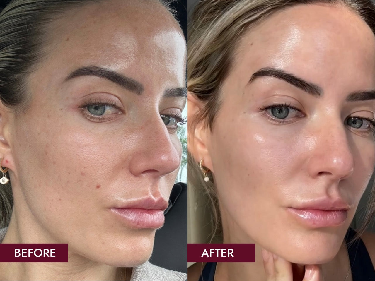 Before_and_Afters_SIDE_BY_SIDE_10_Weeks_Results_Large_caf64944-fe21-4686-aa74-75488cf25e04.jpg