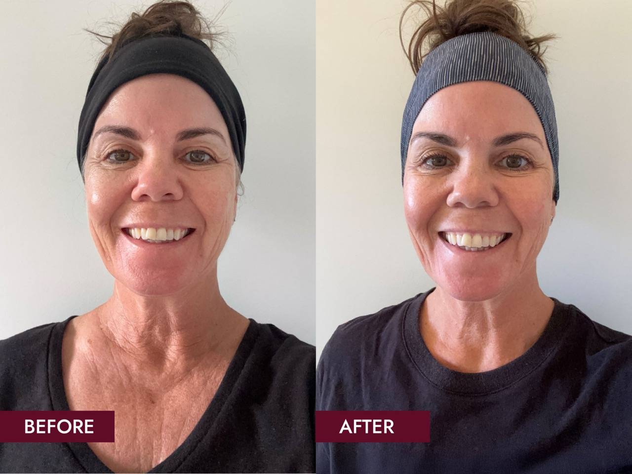 Before_and_Afters_SIDE_BY_SIDE_11_Weeks_Results_Large_7d29f09e-154f-41c4-a83a-f1444f60b3df.jpg