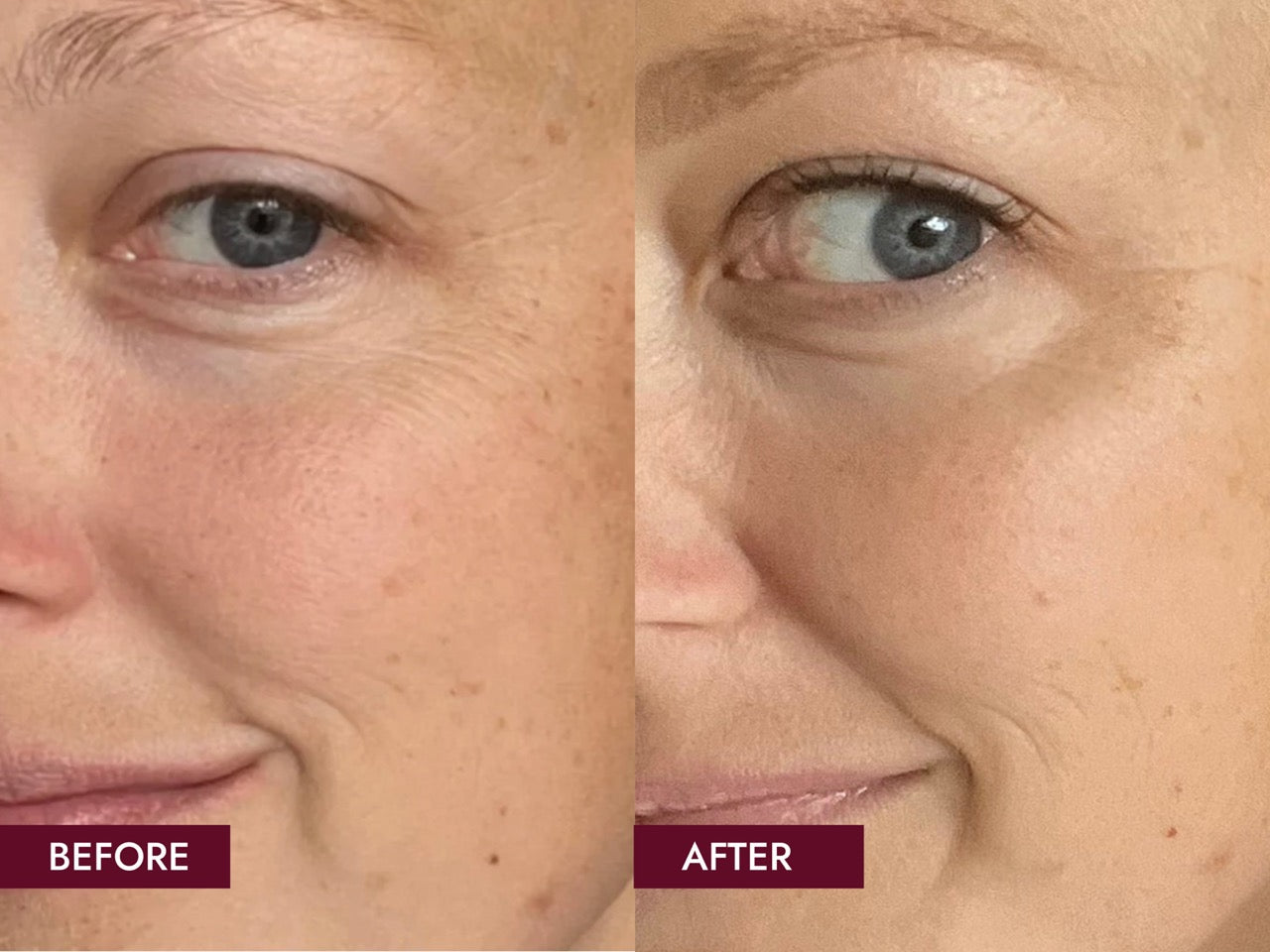 Before_and_Afters_SIDE_BY_SIDE_12_Weeks_Results_Large_6100c2fa-039e-4944-ad7e-e7778e9bbd4a.jpg