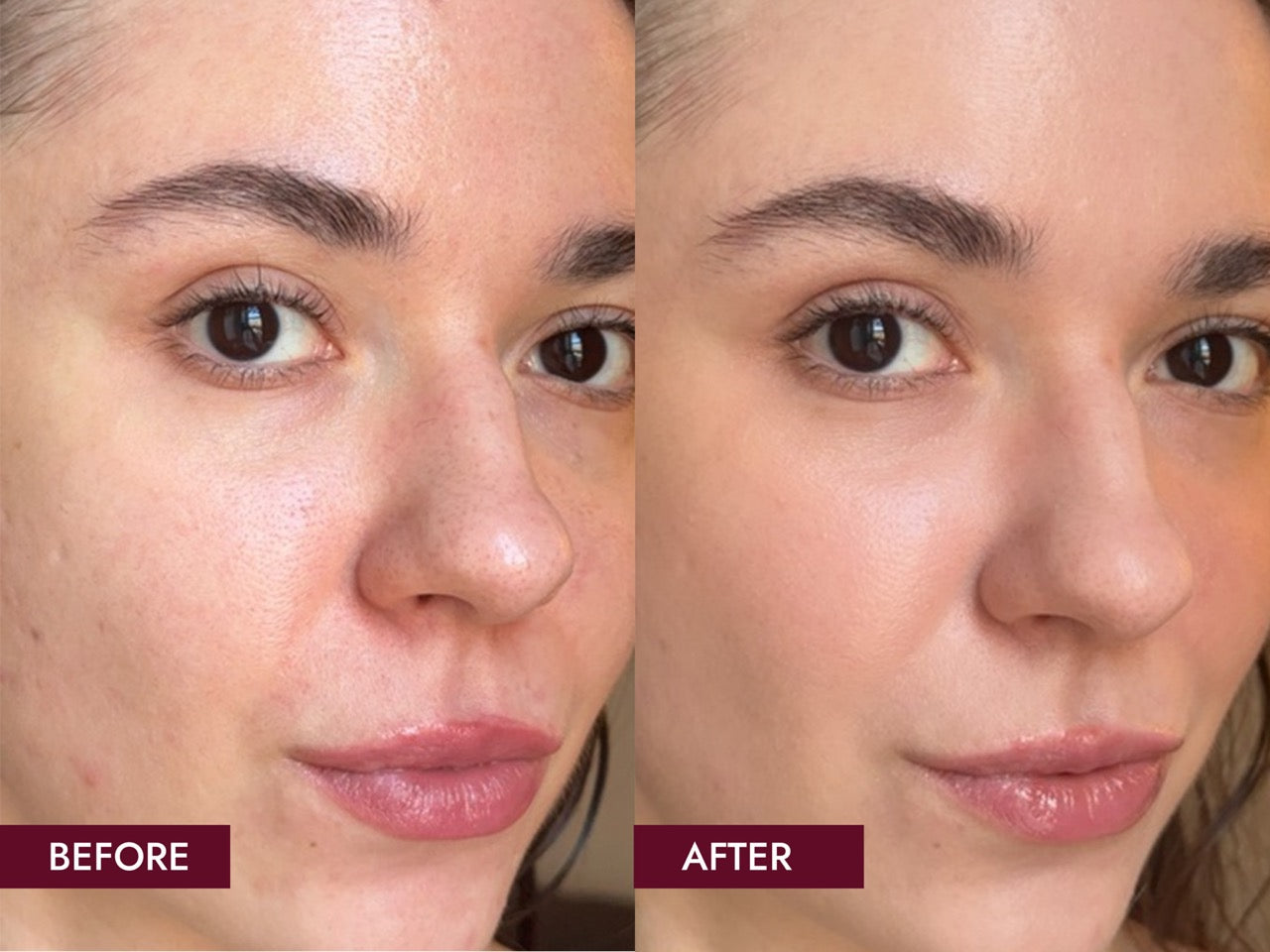 Before_and_Afters_SIDE_BY_SIDE_6_Weeks_Results_Large_64942c0c-3bc9-4ac0-9c36-a035f4751097.jpg