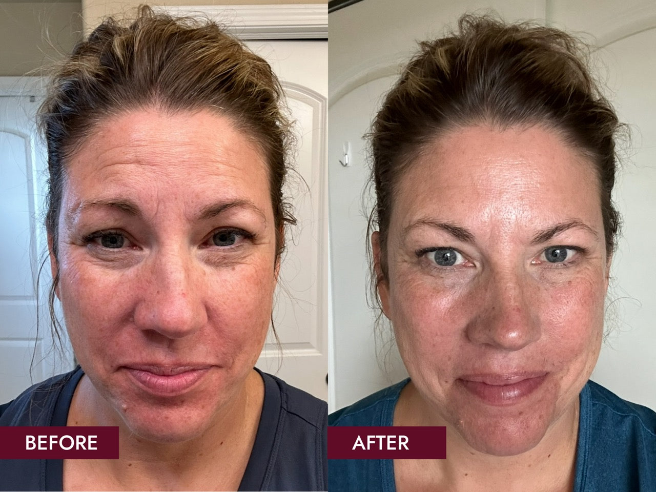 Before_and_Afters_SIDE_BY_SIDE_7_Weeks_Results_Large_bfa341c0-f0b3-44b3-a406-ac21b93c9a38.jpg