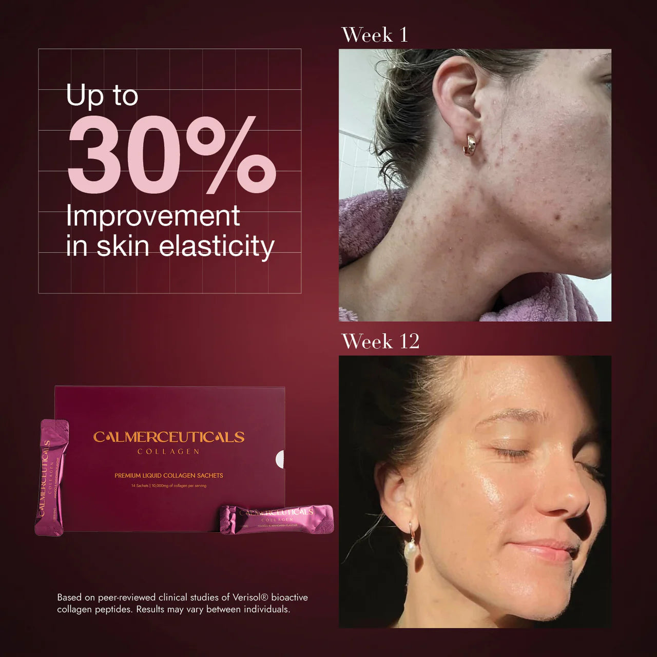 VERISOL® Enhanced Marine Collagen