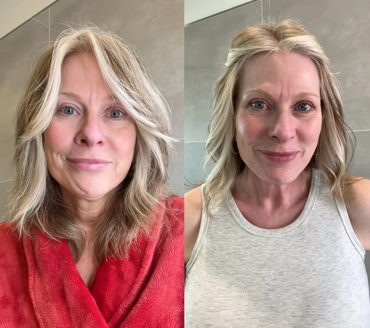 Before and after — Redness calmed & lift