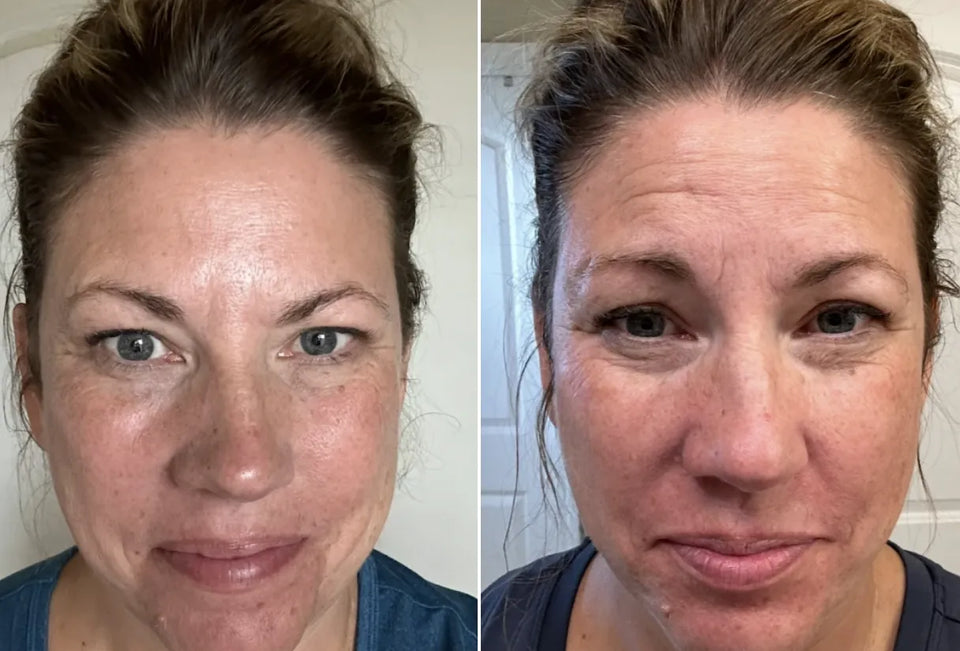Before and after result