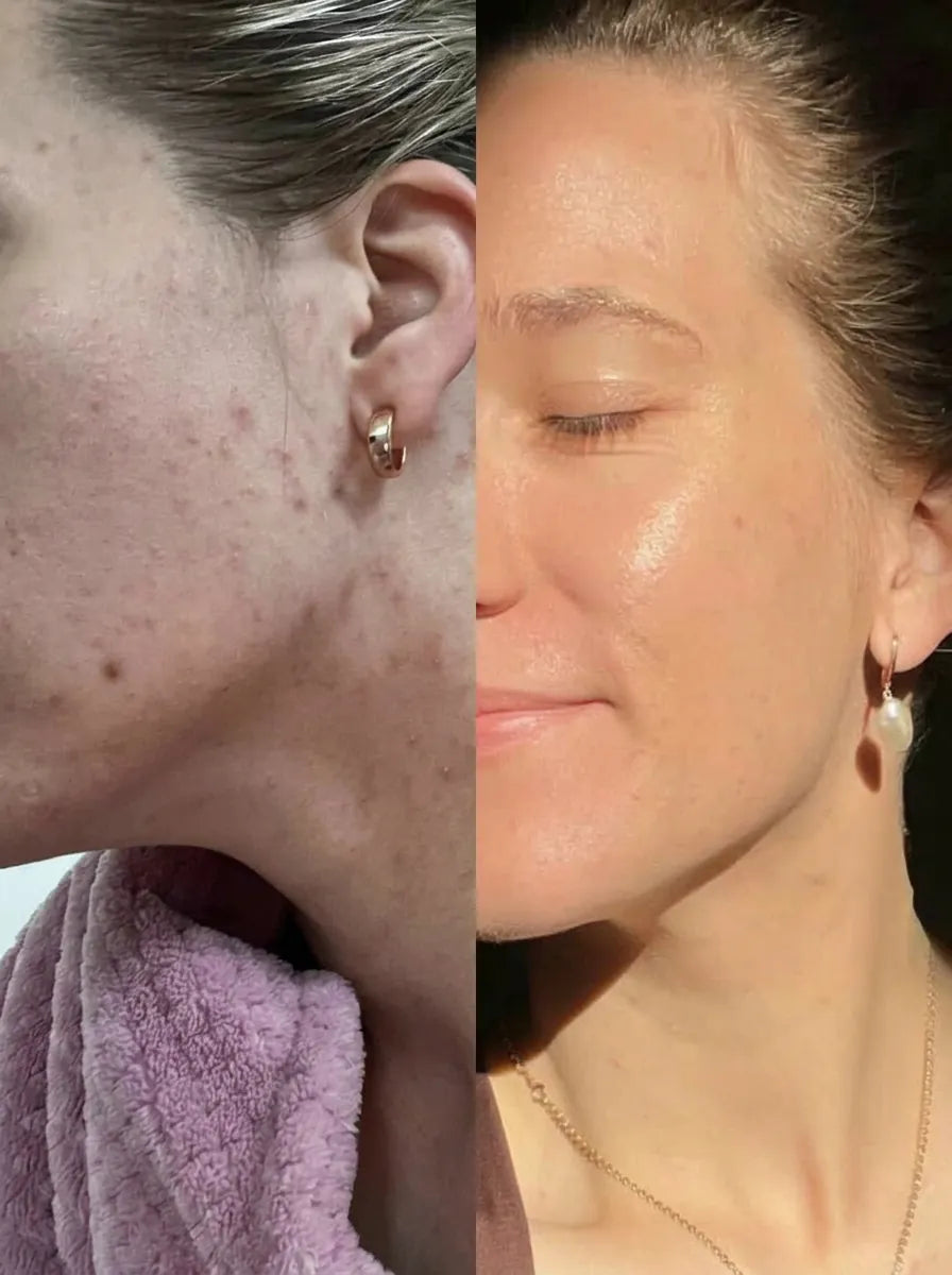 Before and after — Radiance & glow