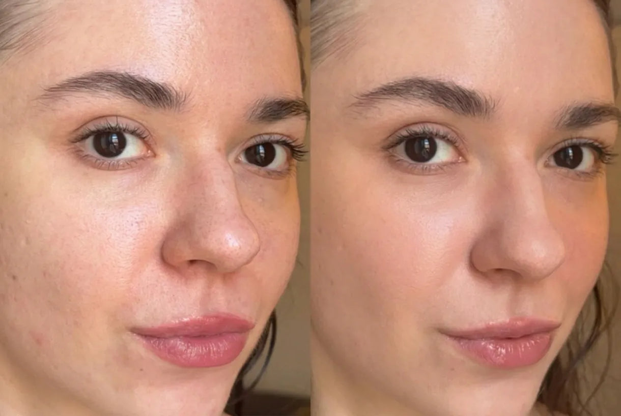 Before and after — Fine lines softened