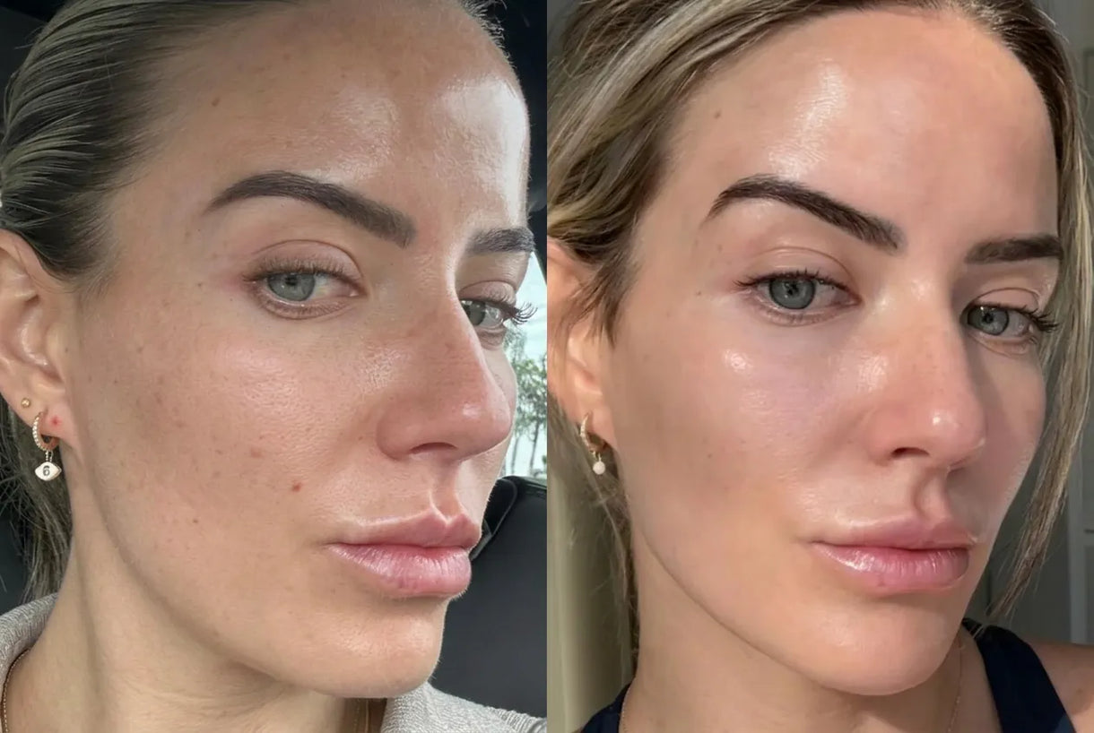 Before and after — Pore refinement