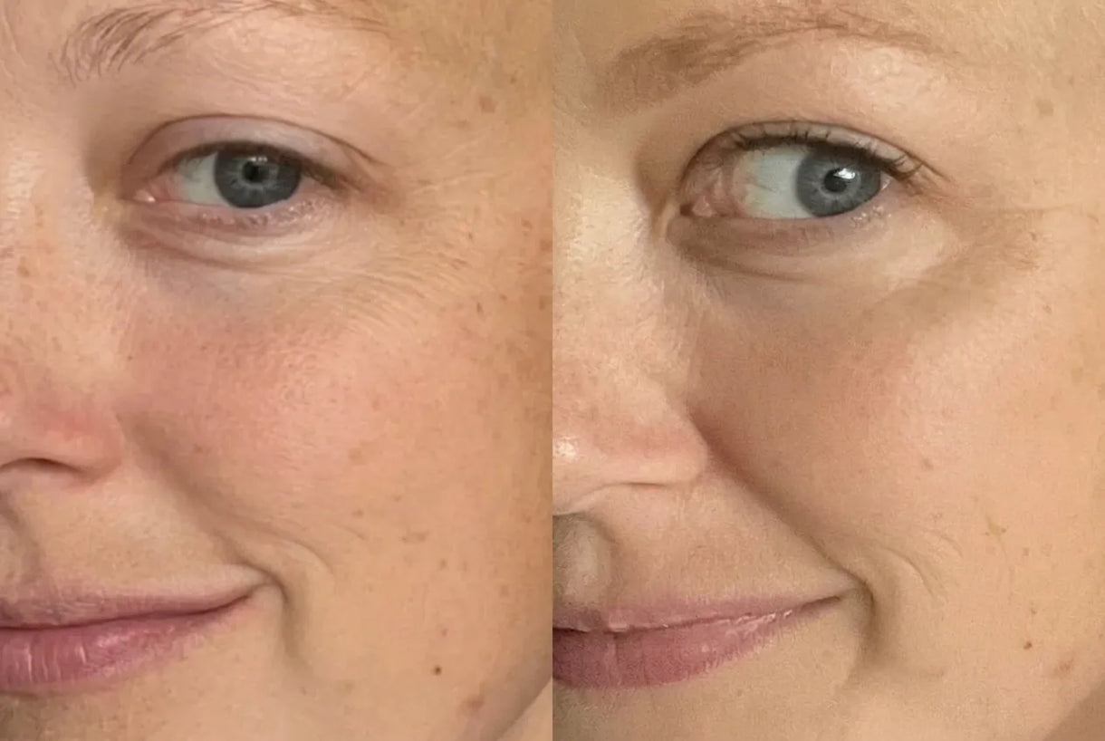 Before and after — Hydration restored